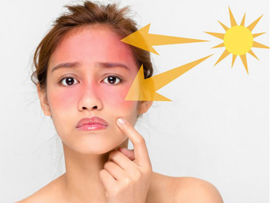 Tác hại tia UV lên vùng da quanh mắt và mắt