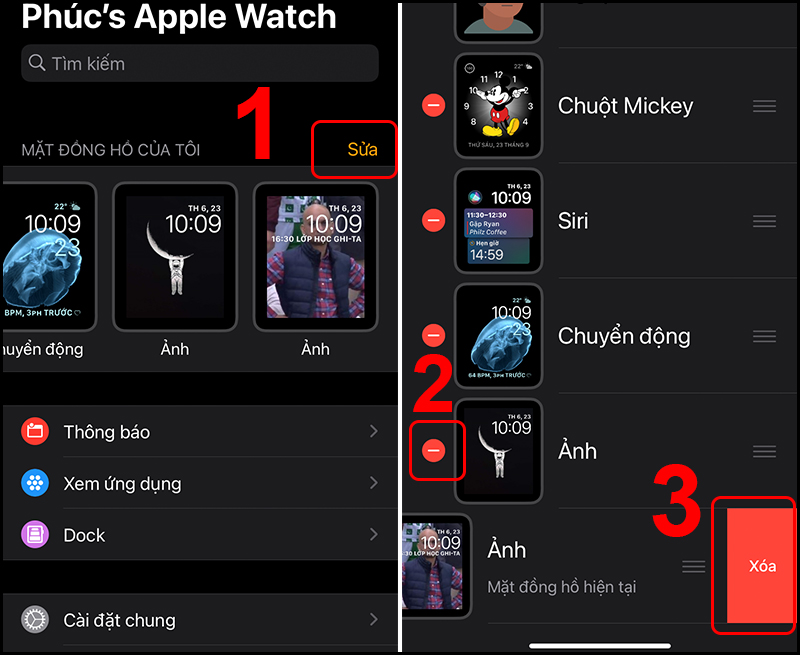 Xóa bớt mặt đồng hồ để Apple Watch gọn gàng hơn