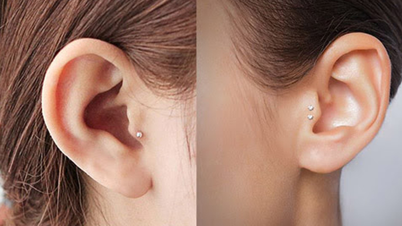 Vị trí Tragus