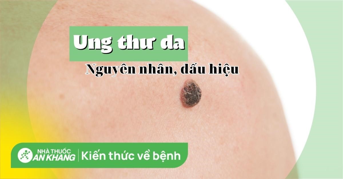 Ung Thư Da: Nguyên Nhân, Dấu Hiệu Và Biến Chứng Bạn Nên Biết