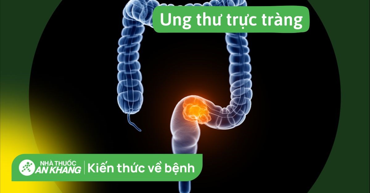 Tỷ lệ tử vong cao của ung thư trực tràng là do những nguyên nhân gì?
