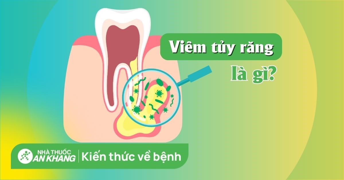 Viêm tủy răng: Dấu hiệu, biến chứng, cách điều trị và phòng ngừa