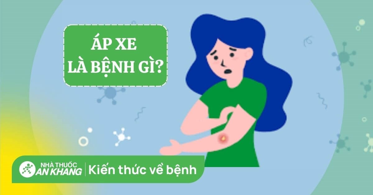 Áp xe: Nguyên nhân, dấu hiệu, chẩn đoán và điều trị
