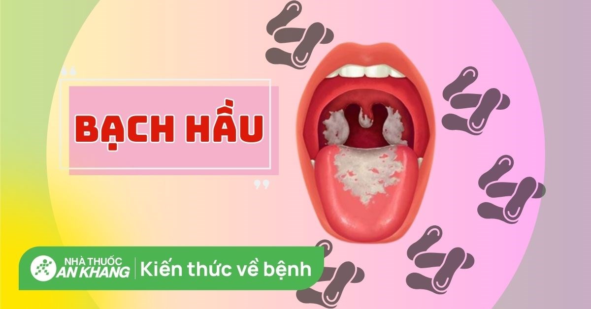Bệnh bạch hầu: Nguyên nhân và dấu hiệu nhận biết sớm