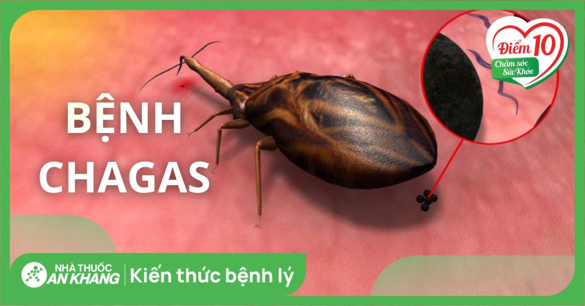 Bệnh Chagas là bệnh gì? Nguyên nhân, dấu hiệu, biến chứng và cách điều trị