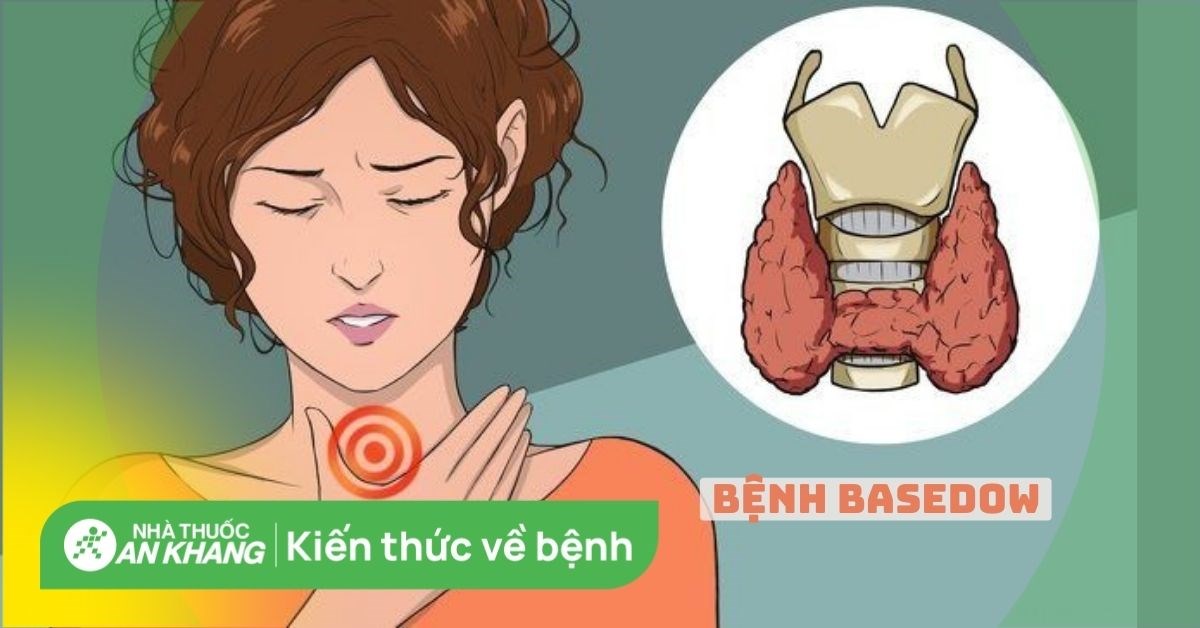 Bệnh Basedow: Nguyên nhân, triệu chứng và cách điều trị hiệu quả