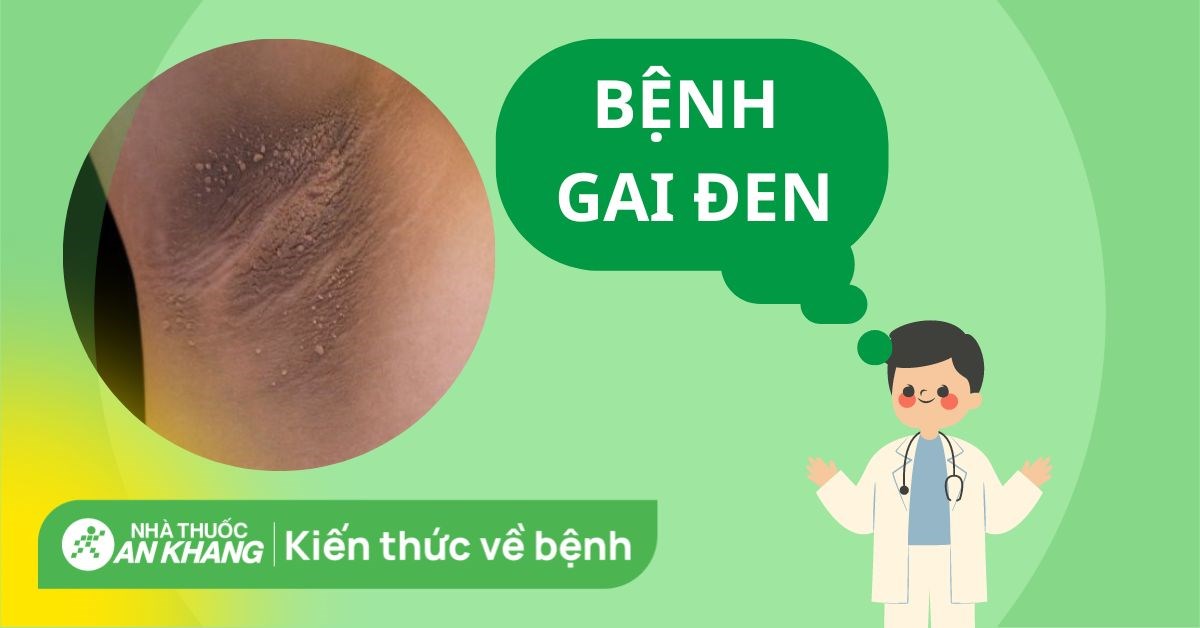 Thuốc Trị Gai Đen: Giải Pháp Hiệu Quả Cho Làn Da Khỏe Mạnh