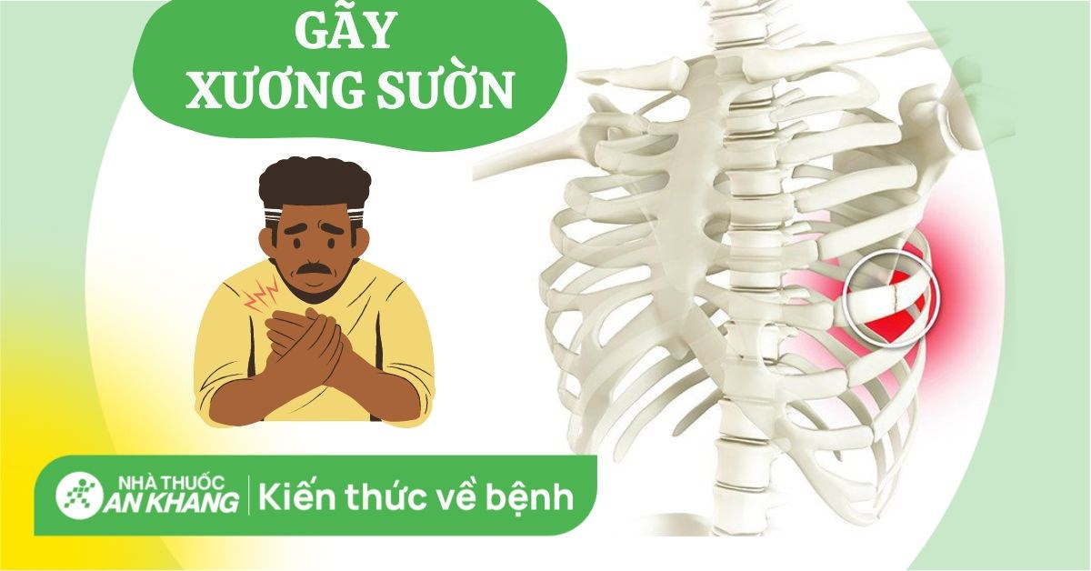 Tác động của gãy xương sườn đến cuộc sống hàng ngày và cách thích nghi.