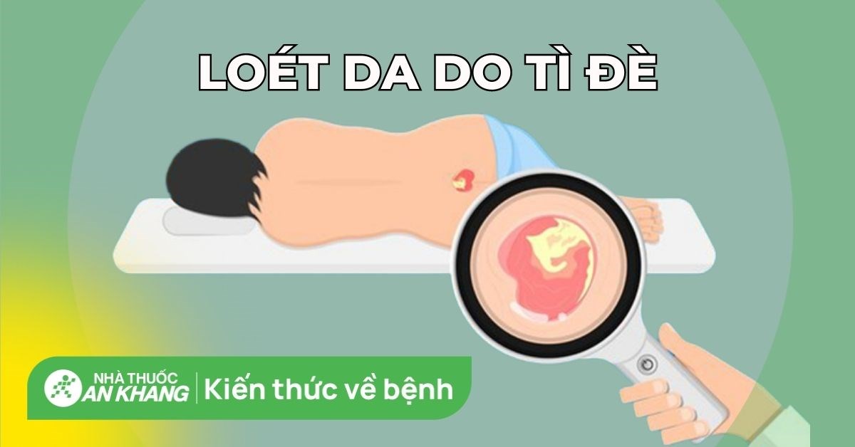 Vết loét do tì đè: Nguyên nhân, cách xử lý và biến chứng