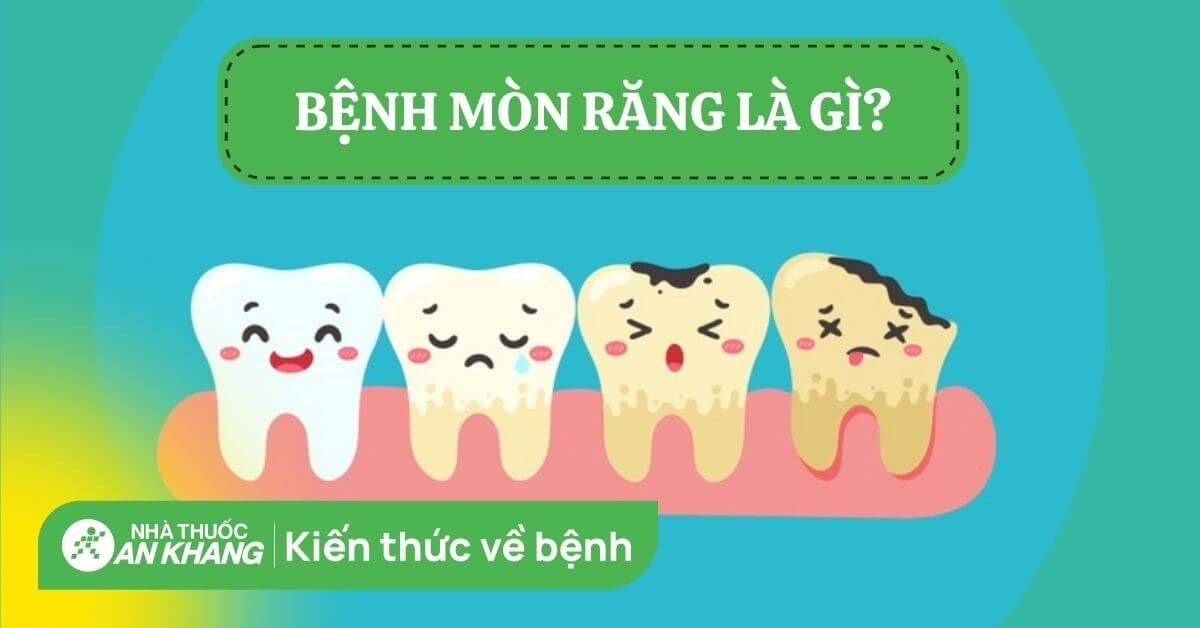 Mòn răng: Nguyên nhân, dấu hiệu và cách điều trị hiệu quả
