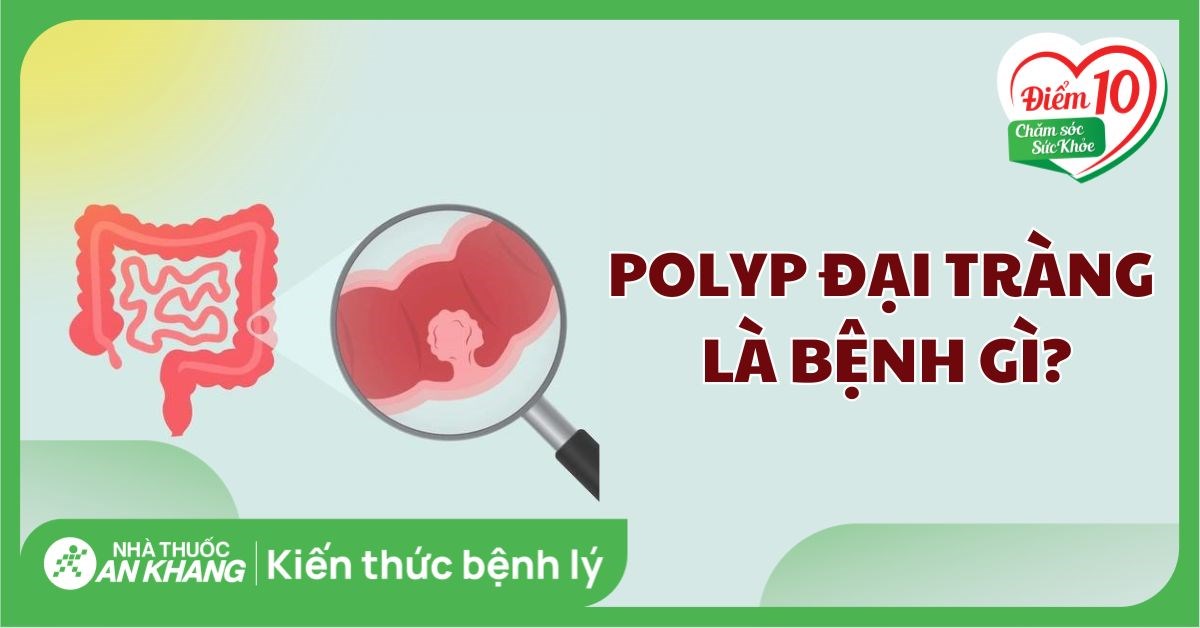Polyp đại tràng là gì? Có nên cắt polyp đại tràng không?