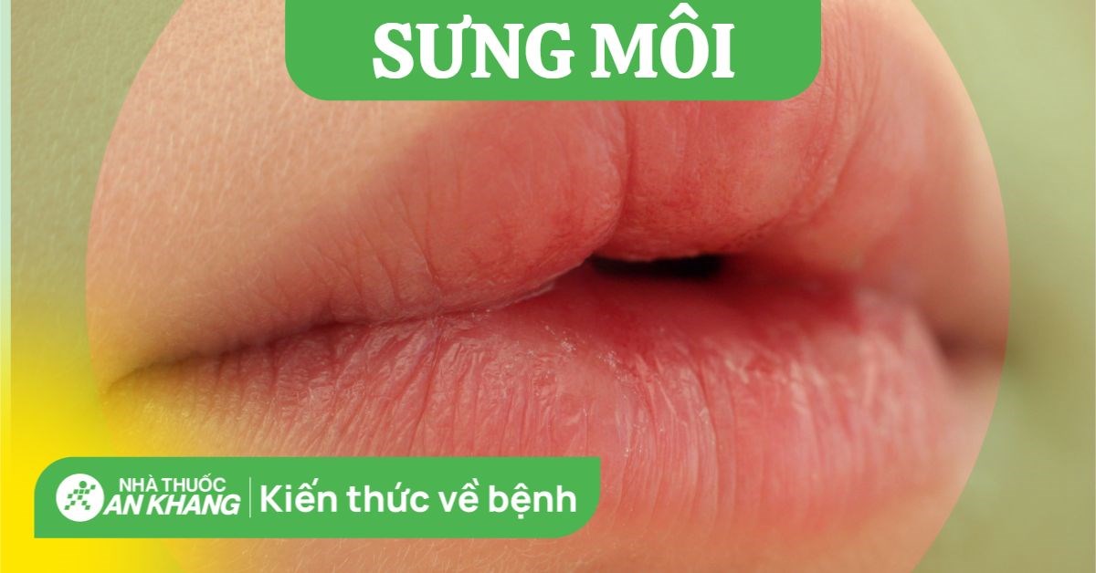 Sưng môi: Nguyên nhân và những biến chứng nguy hiểm bạn nên biết