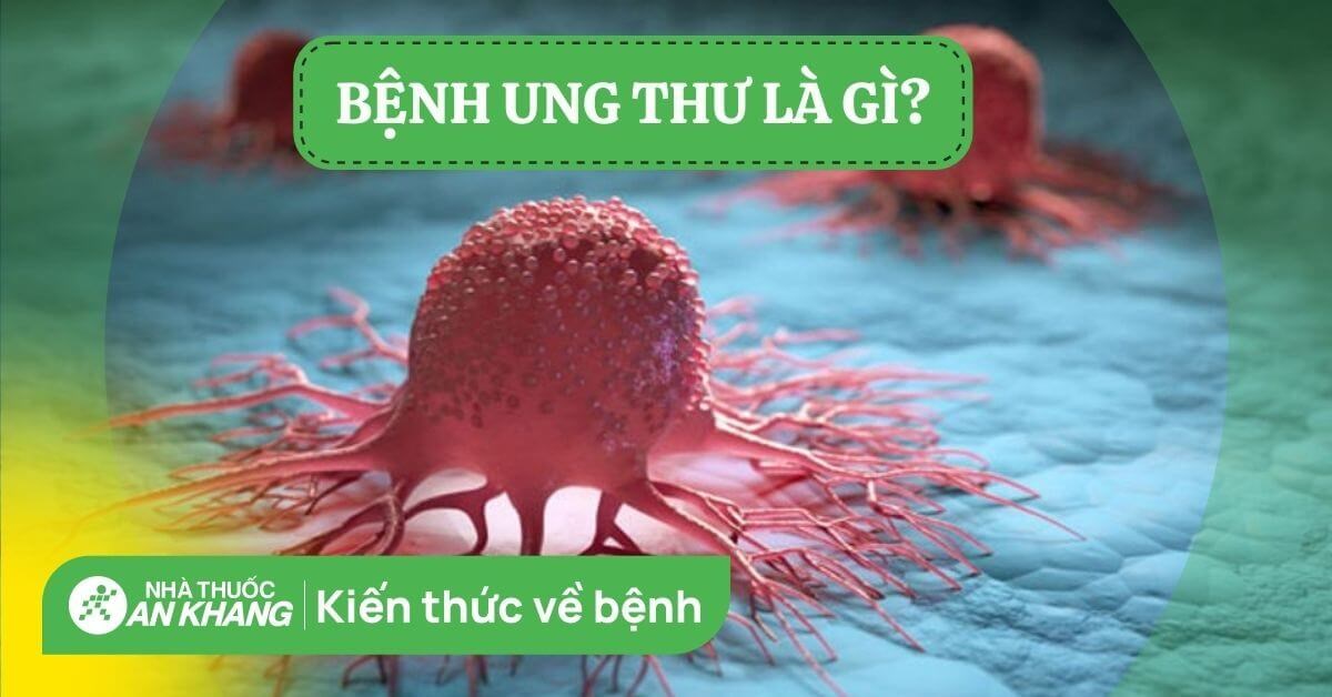 Ung thư là bệnh gì? Dấu hiệu, cách điều trị và phòng ngừa