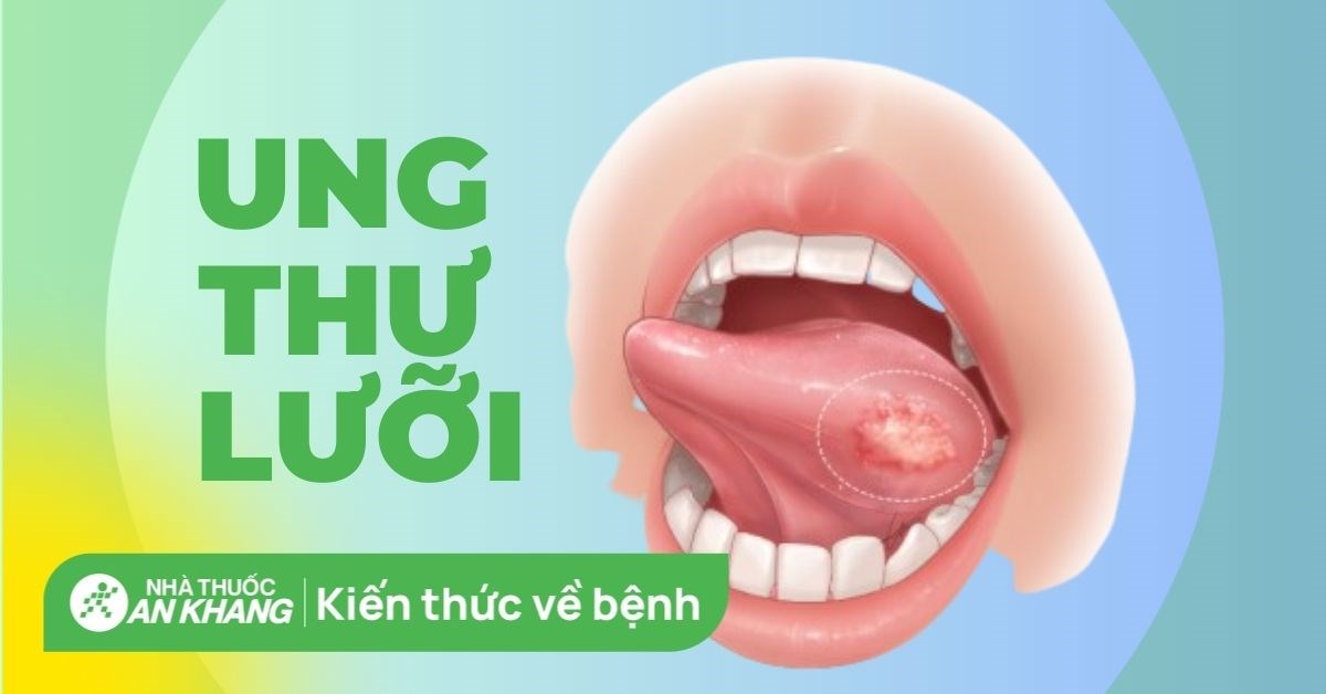 Phương pháp điều trị nào hiệu quả cho ung thư lưỡi?