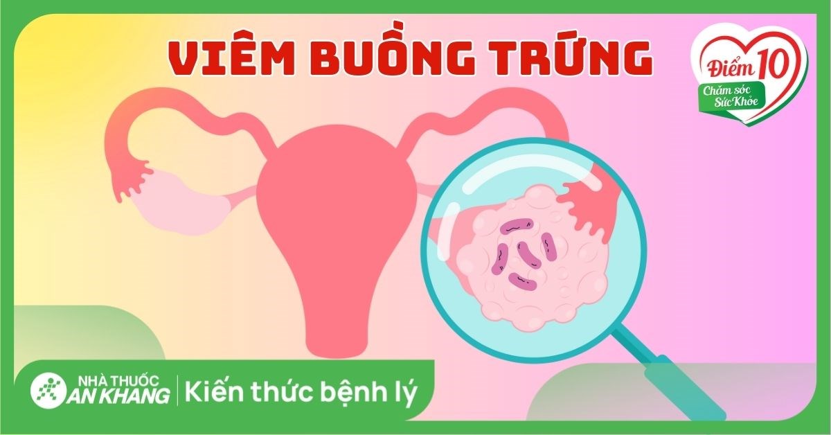 Viêm buồng trứng: Nguyên nhân, dấu hiệu, cách chẩn đoán và điều trị