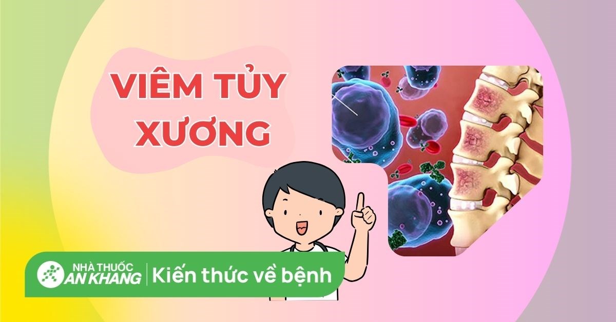 Viêm tủy xương: Nguyên nhân, dấu hiệu, biến chứng, điều trị