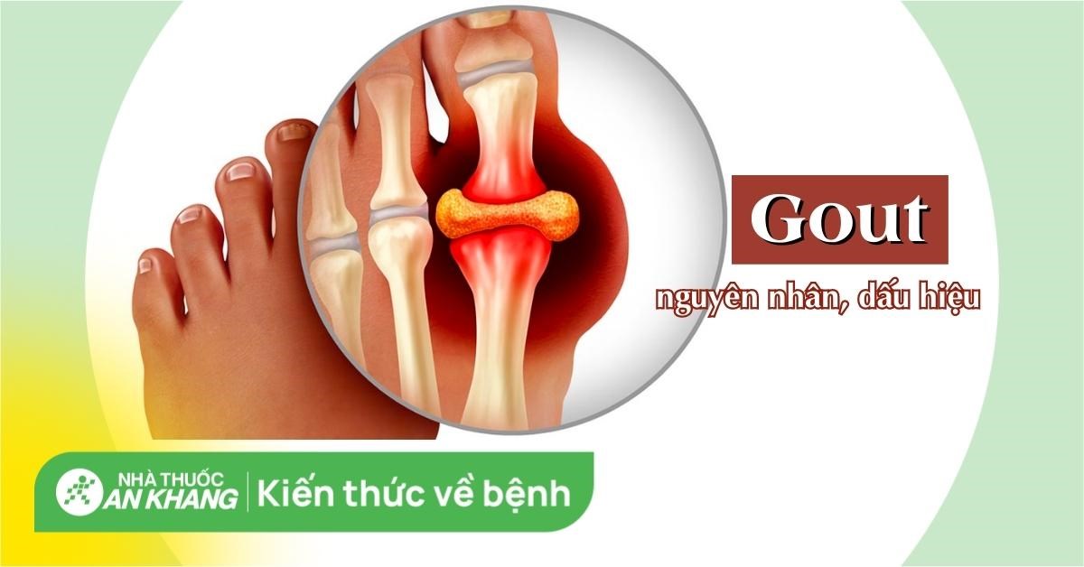 Ngoài công thức âm thanh, goût còn có cách sử dụng khác trong ngôn ngữ tiếng Pháp không? Bạn có thể đề cập đến một số cụm từ hay được sử dụng kèm theo goût trong các câu?
