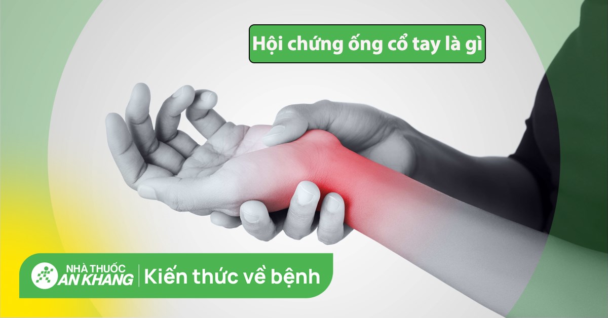  Hội chứng ống cổ tay khi mang thai : Tìm hiểu thông tin chi tiết và cách chữa trị