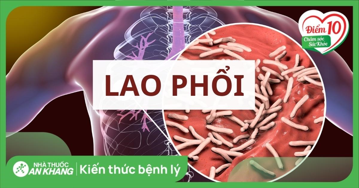 Lao phổi là gì? Nguyên nhân, triệu chứng, chẩn đoán, điều trị