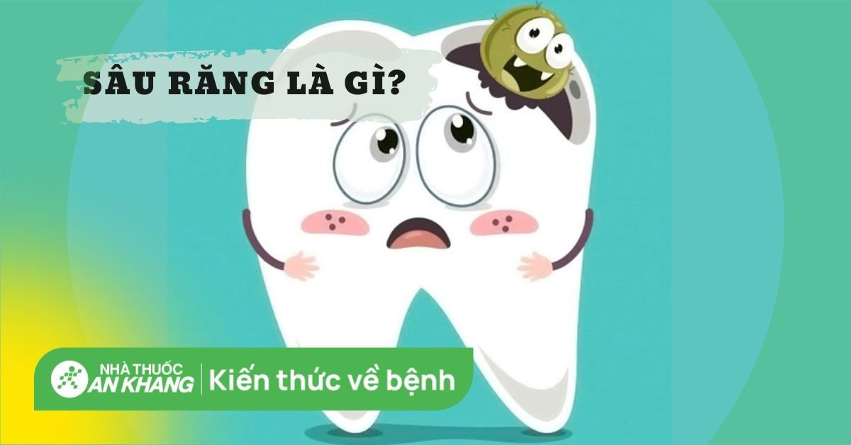 Thời gian điều trị sâu răng vĩnh viễn bằng thuốc là bao lâu?
