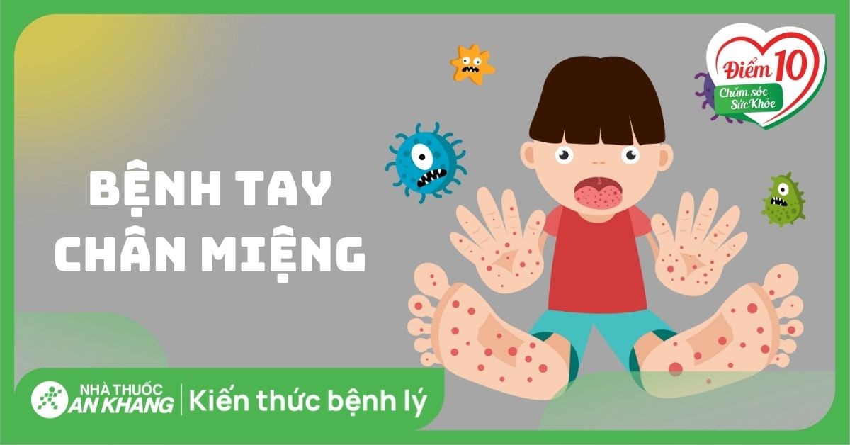 Bệnh tay chân miệng: Dấu hiệu và cách điều trị
