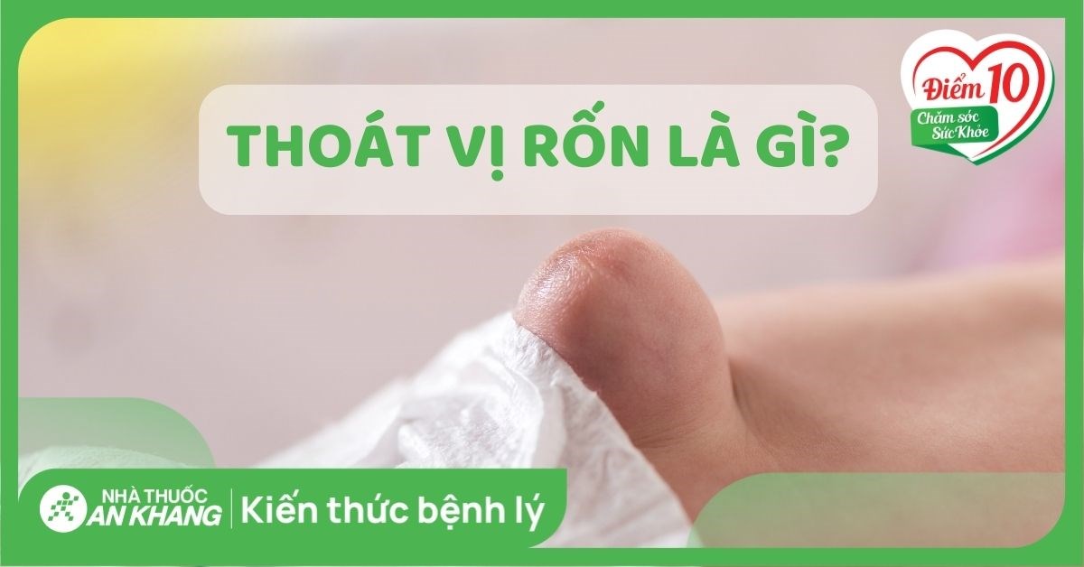 Thoát vị rốn là gì? Nguyên nhân và cách điều trị hiệu quả