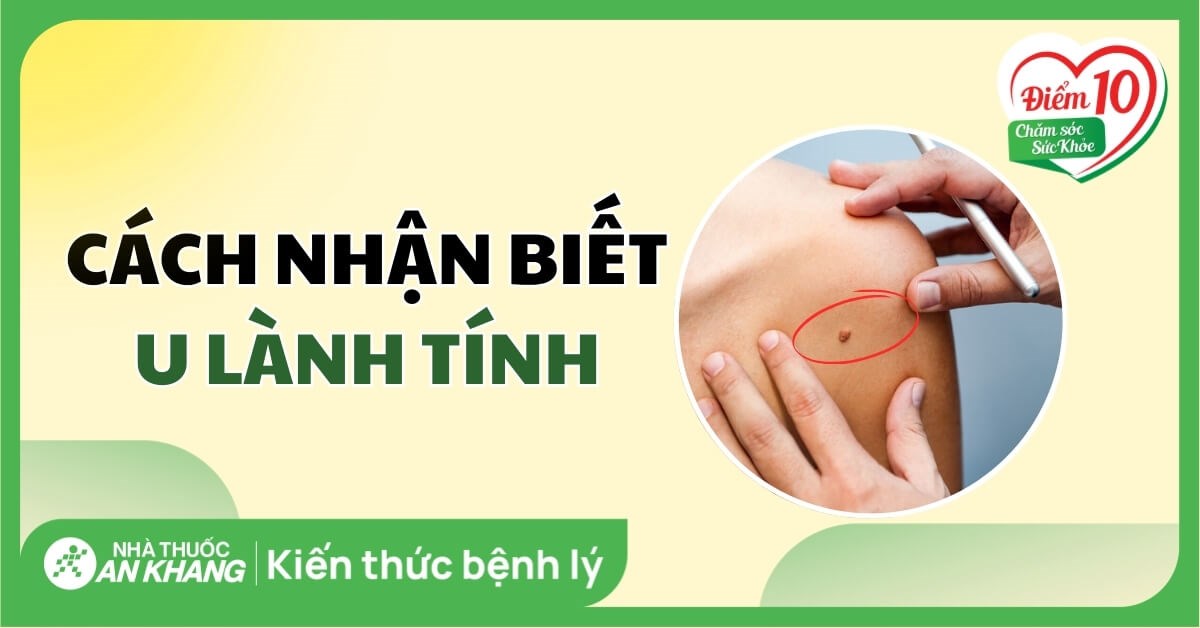 Angliyada kattalar porno