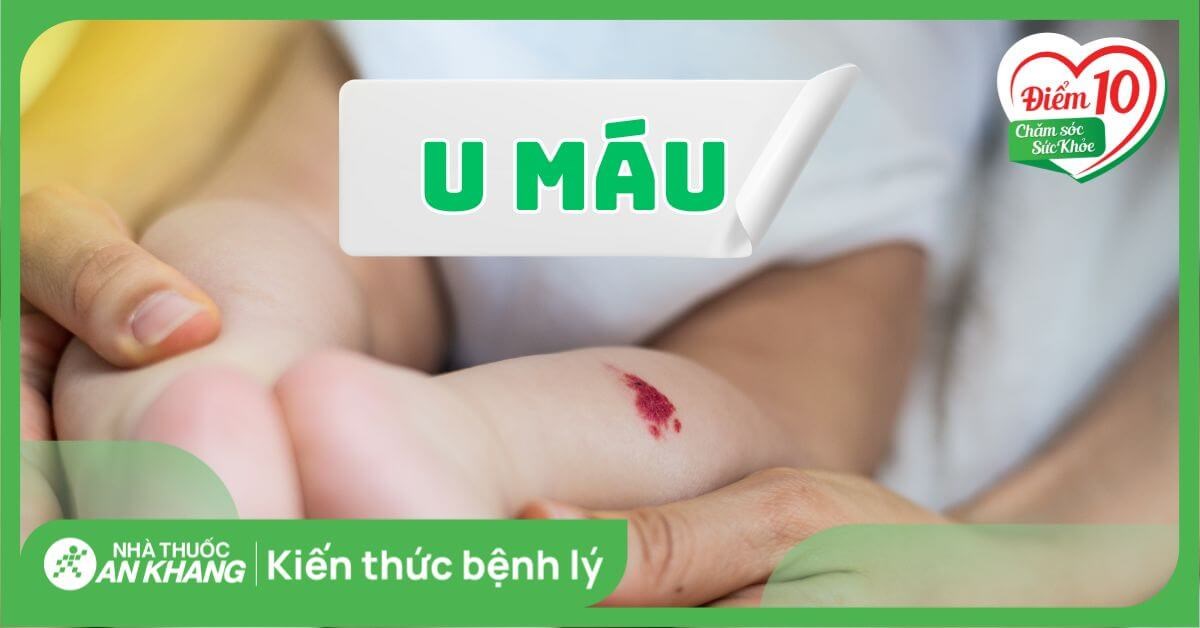 U máu là gì? Dấu hiệu, nguyên nhân và cách điều trị