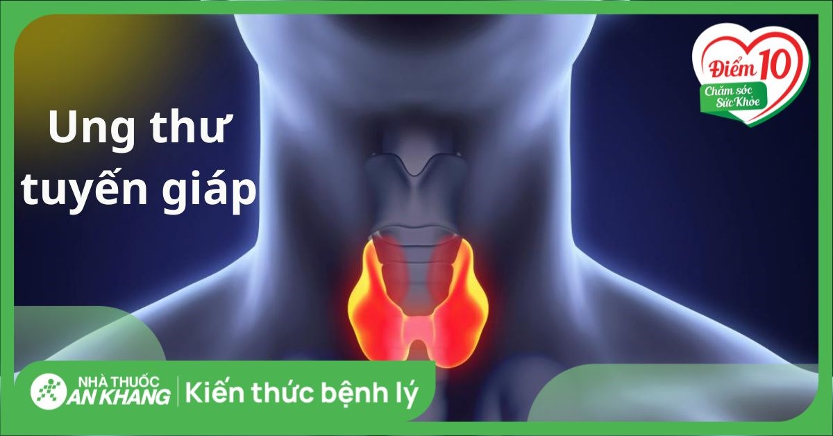 Ung thư tuyến giáp: Nguyên nhân, triệu chứng và cách phòng ngừa