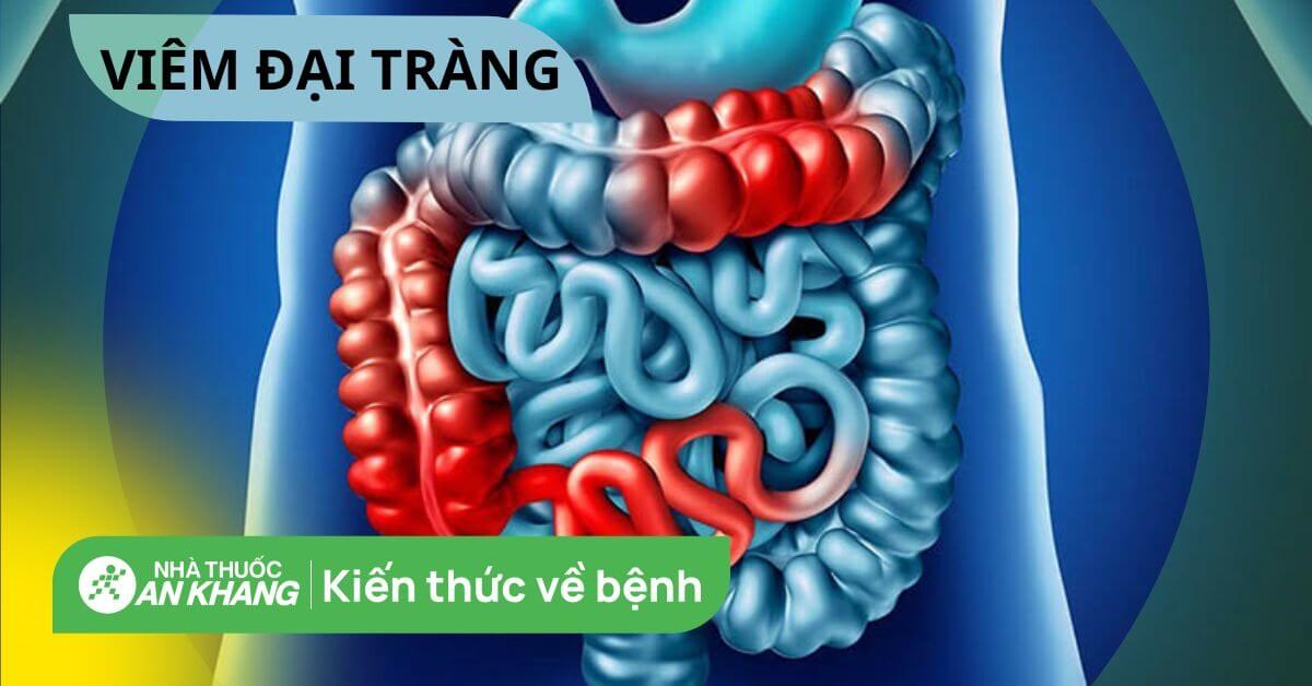 Khi cảm thấy triệu chứng đau bụng, người bệnh có nên tự chữa trị hay cần tìm kiếm sự tư vấn y tế?
