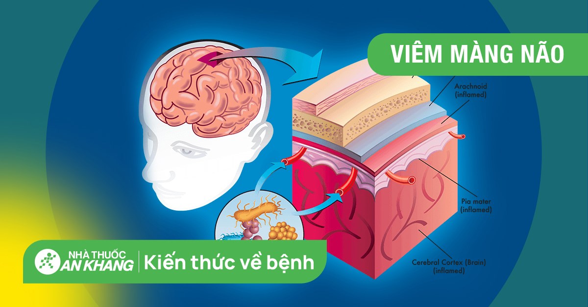 Phù não là gì và nguyên nhân gây ra phù não?
