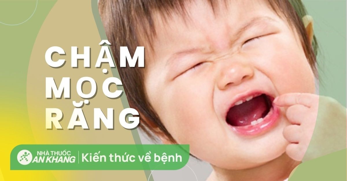 Trẻ chậm mọc răng có sao không? Nguyên nhân và cách khắc phục hiệu quả