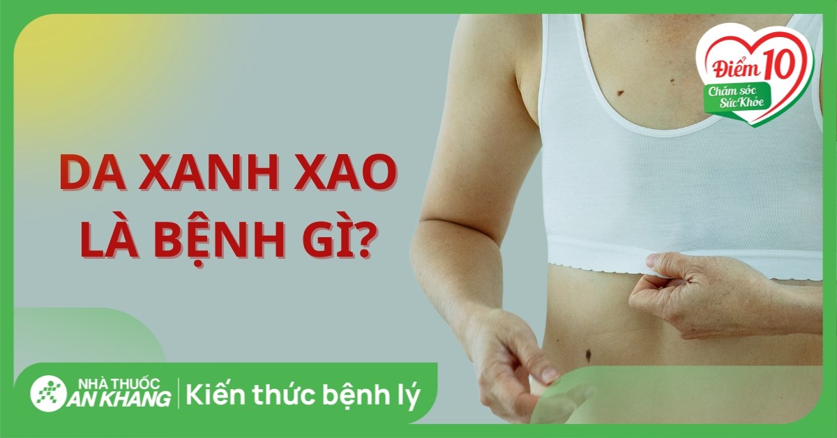 Da xanh xao là bệnh gì? Làm sao để da hồng hào trở lại