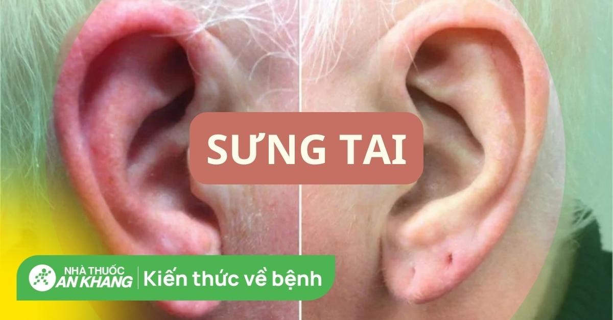 Sưng tai có sao không? Các nguyên nhân gây sưng tai và cách xử trí